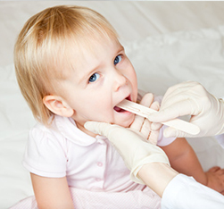 faringotonsillite bambino